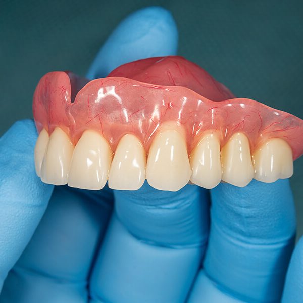 protese-dentaria-1